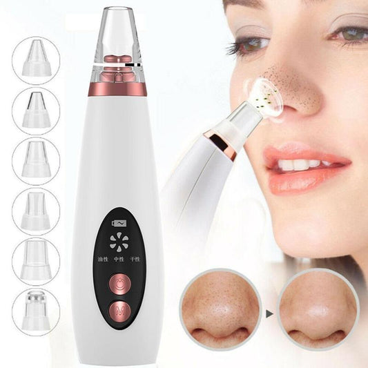 Pore Perfect Blackhead Remover